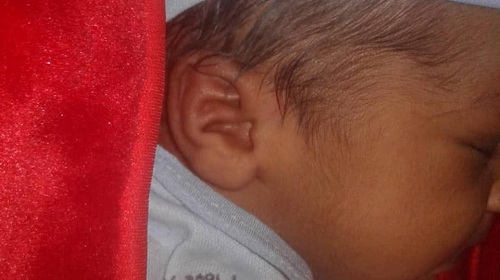 شاهد بالصور ..حالة نادرة طفل مولود بمحافظة البيضاء لفظ الجلالة على إحدى إذنيه