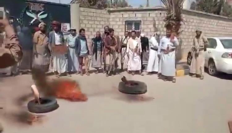 شاهد..مرتزقة تحالف العدوان في مأرب يحرقون أطرافهم التي تساعدهم على المشي لهذا السبب