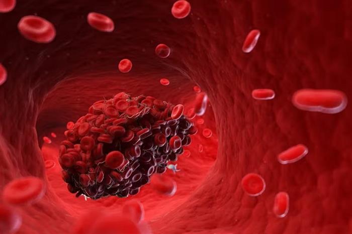 إحذر.. تناول هذا الطعام على الريق قد يسبب لك جلطة