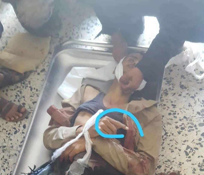 قتلى وجرحى في صفوف مرتزقة السعودية بجبهة الاربعين بمحافظة تعز ..( تفاصيل + اسماء +صور)