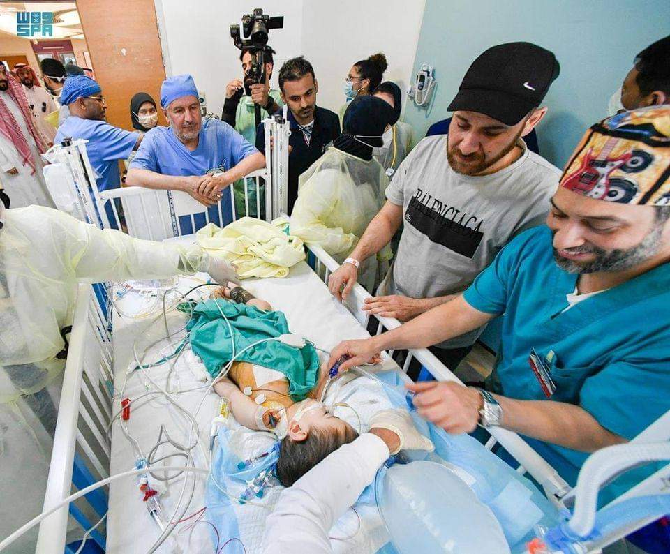 بعد عملية جراحية دقيقة استغرقت 7 ساعات ونصف.. نجاح فصل التوأم السيامي السوري 