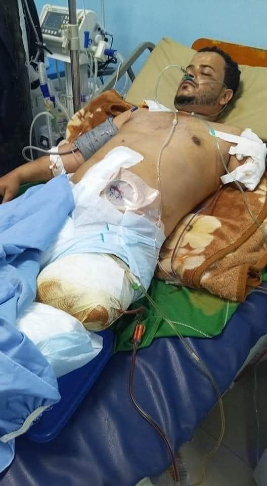 شاب لا يتجاوز من العمر 30 عام .. تم قطع يده اليسار ورجله اليسار بالكامل والسبب خطير .. صور