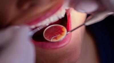 سرطان الفم الأعراض والأسباب ونصائح للوقاية