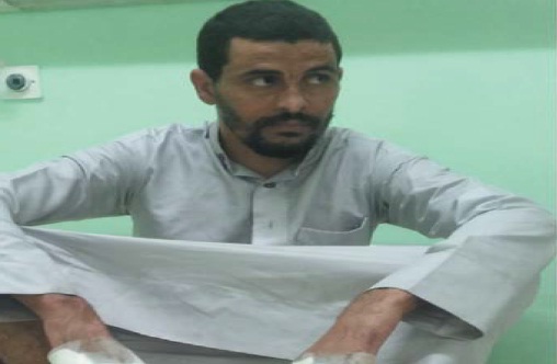 بالصورة..العدو السعودي يطلق سراح الأسير الذي تم تعذيبه بأبشع الطرق الوحشيه بتهمة أنه شقيق السيد عبدالملك الحوثي 