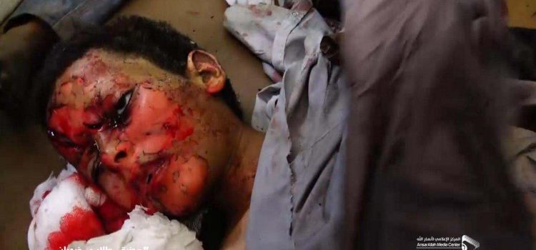 على خلفية مجزرة طيران العدوان بحق أطفال صعدة العفو الدولية توجه دعوة عاجلة لأسبانيا