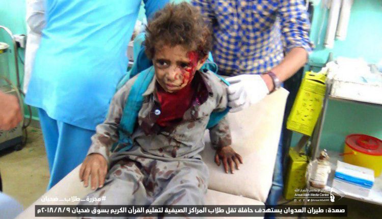 الهيئة الإعلامية لأنصارالله تدين وتستنكر بشدة مجزرة طيران العدوان بحق أطفال صعدة