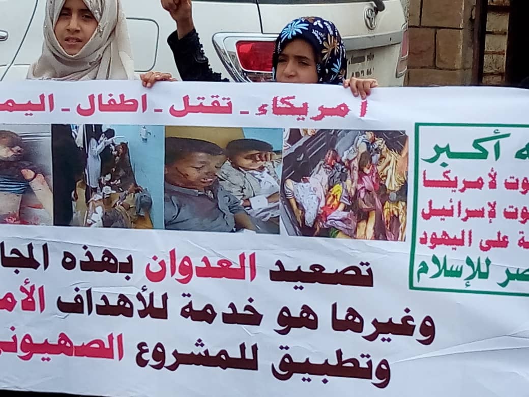 الصحفي المصري سنجاب يا عيباه , عندما يذكر اليمن فتذكر الدماء والأشلاء والارتزاق والعمالة ولكن اليمن لا  بواكي عليه !!