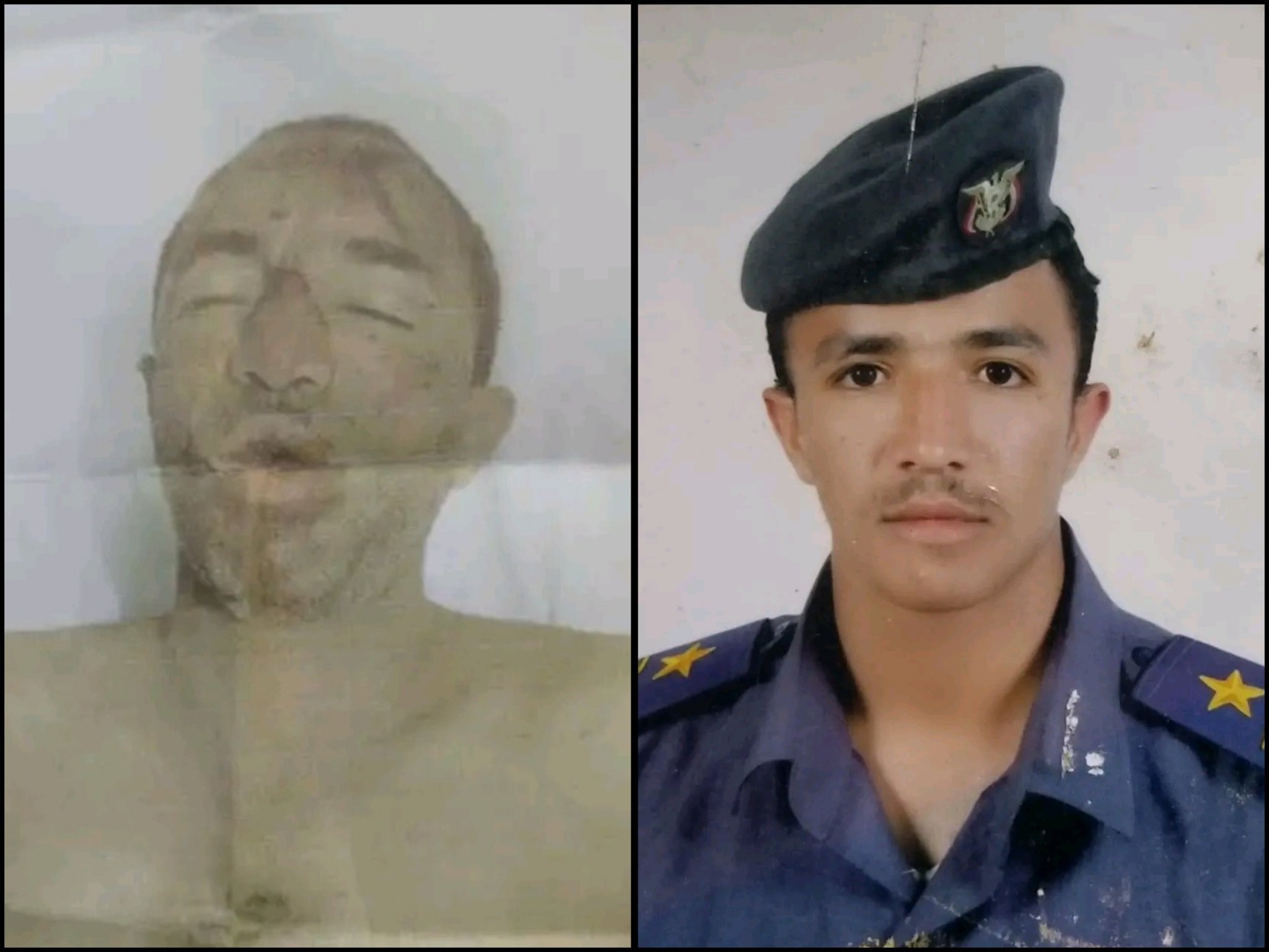 اعتداء وحشي يهز مأرب .. تفاصيل وصور