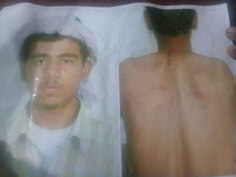 شاهد بالصورة تعذيب مواطن35 ساعة في ادارة أمن بيحان على الطريقة الإماراتية