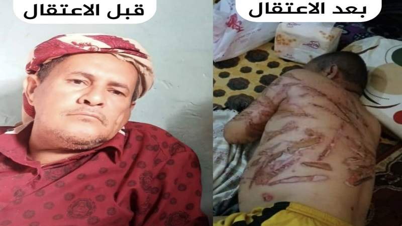 بالاسم والصورة .. مقتل مواطن بعد اختطافه وتعذيبه بوحشية في أحد المحافظة اليمنية ..