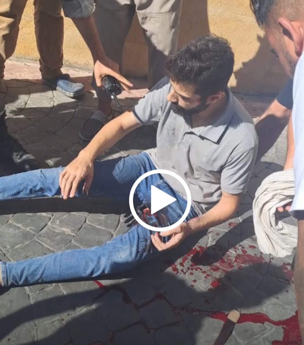 انفجار أجهزة لاسلكي مخترقة في لبنان وأصابة المئات من المواطنين(فيديو)