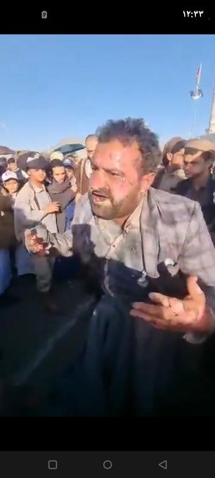 هام وبالصور .. بيان صادر عن مكتب الهيئة العامة للأوقاف بأمانة العاصمة بشأن المدعو الذي حاول يحرق نفسة  (عبد الغني الرازحي)