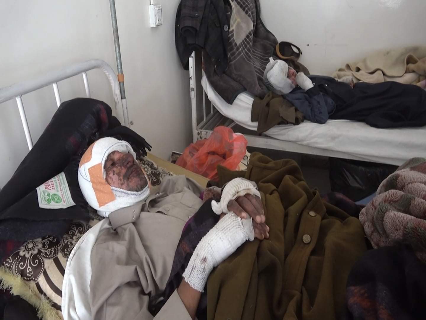 عمران : اسطوانات الغاز التالفة حربا اخرى لمرتزقة العدوان في خطف أرواح اليمنيين