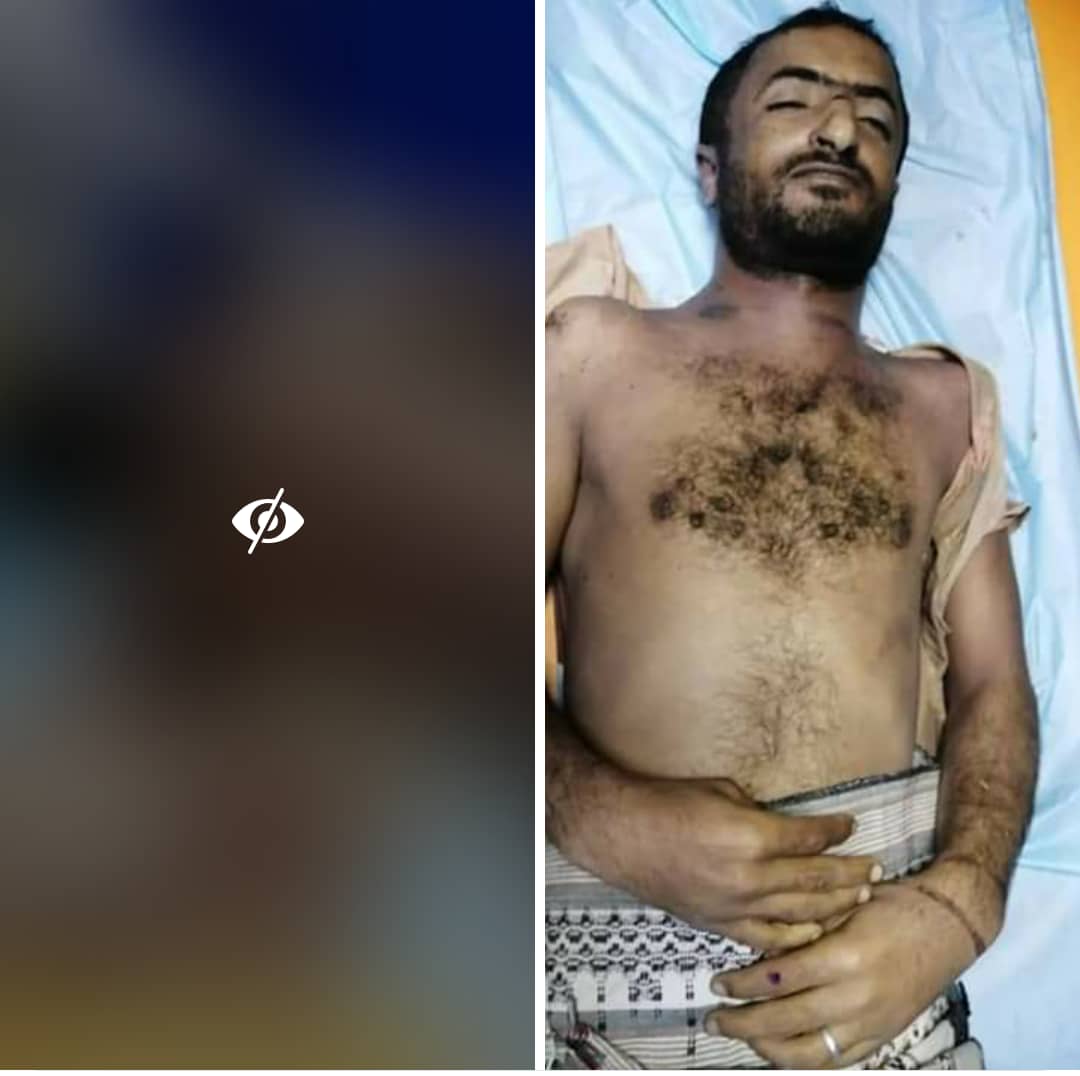 تعذيب جندي يمني حتى الموت في مايسمى لواء النخبه التابع للامارات ( الاسم + الصوره )