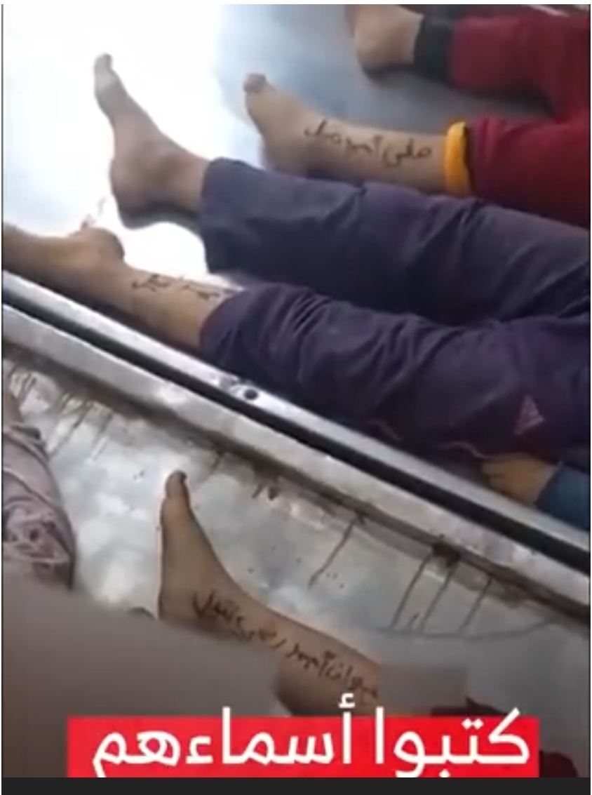 شاهد بالفيديو اطفال فلسطينيين يكتبون أسماؤهم على اجسادهم لكي يسهل التعرف عليهم اذا استشهدوا في القصف وبالفعل تم التعرف عليهم بعد استشهادهم بغارات العدو الغاصب