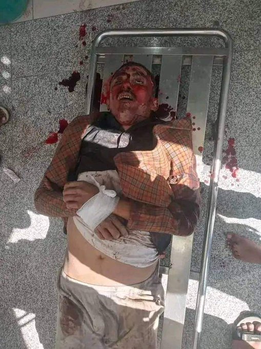 شاهد بالصورة جثة القيادي في حزب الاصلاح المخلافي بعد مقتله بلحظات اثناء قيامة بمحاولة اقتحام احد المعسكرات في تعز جنوب غرب اليمن