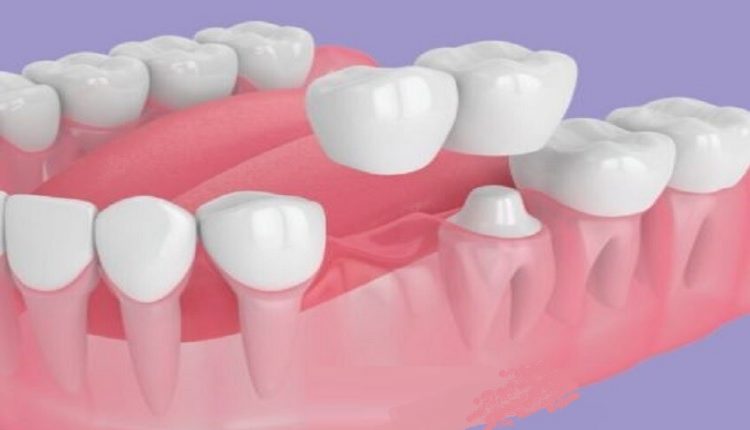 ابتكار روسي يحدث ثورة في طب الأسنان ويمنح المرضى أملاً جديداً بعلاج أقل تكلفة وأطول عمراً