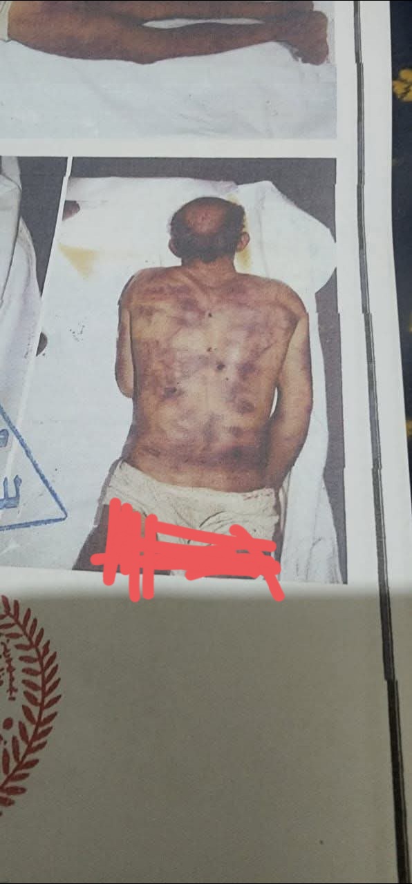 جريمة تهز الضمير.. ليست جريمة قتل بل حفلة تعذيب وحشية.. صور صادمة لعبدالسلام الطرصاني اشعلت موجة غضب واسعة