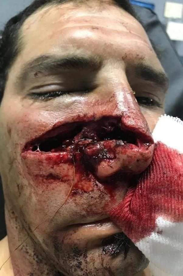 صور .. وحش مفترس في محافظة .. يهاجم مواطن يمني وهكذا كان مصيره