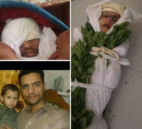 شاهد بالصورة المواطن الذي انتحر وبخضنه طفله من رأس جبل في صنعاء بعد ان فارقا الحياة