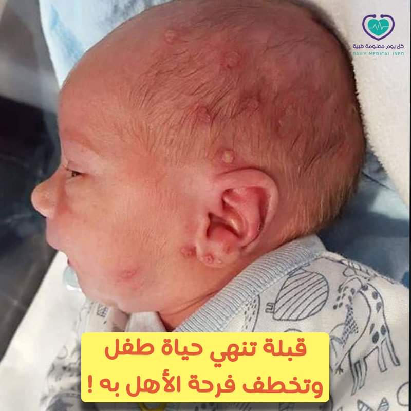 هل ممكن لقبلة إنهاء حياة طفلك ؟! للأسف هذاء ماحدث فعلآ