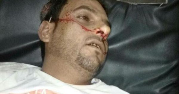 شاهد بالصورة العثور على جثة شخص مقتول بمحافظة لحج