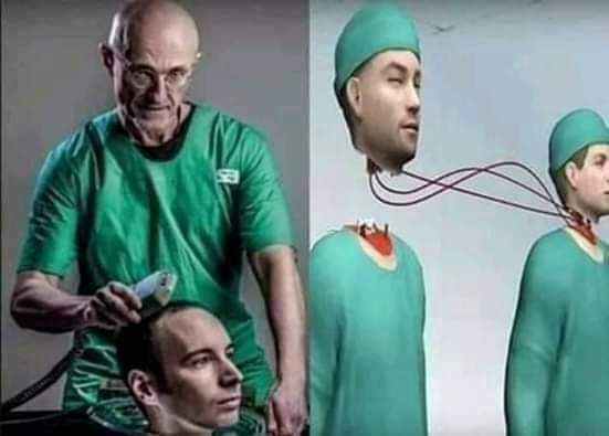 باقي من الزمن 8 شهور على اجراء اول عملية نقل زراعة رأس بشري في التاريخ..( اسم الدكتور - تكلفة العمليه )