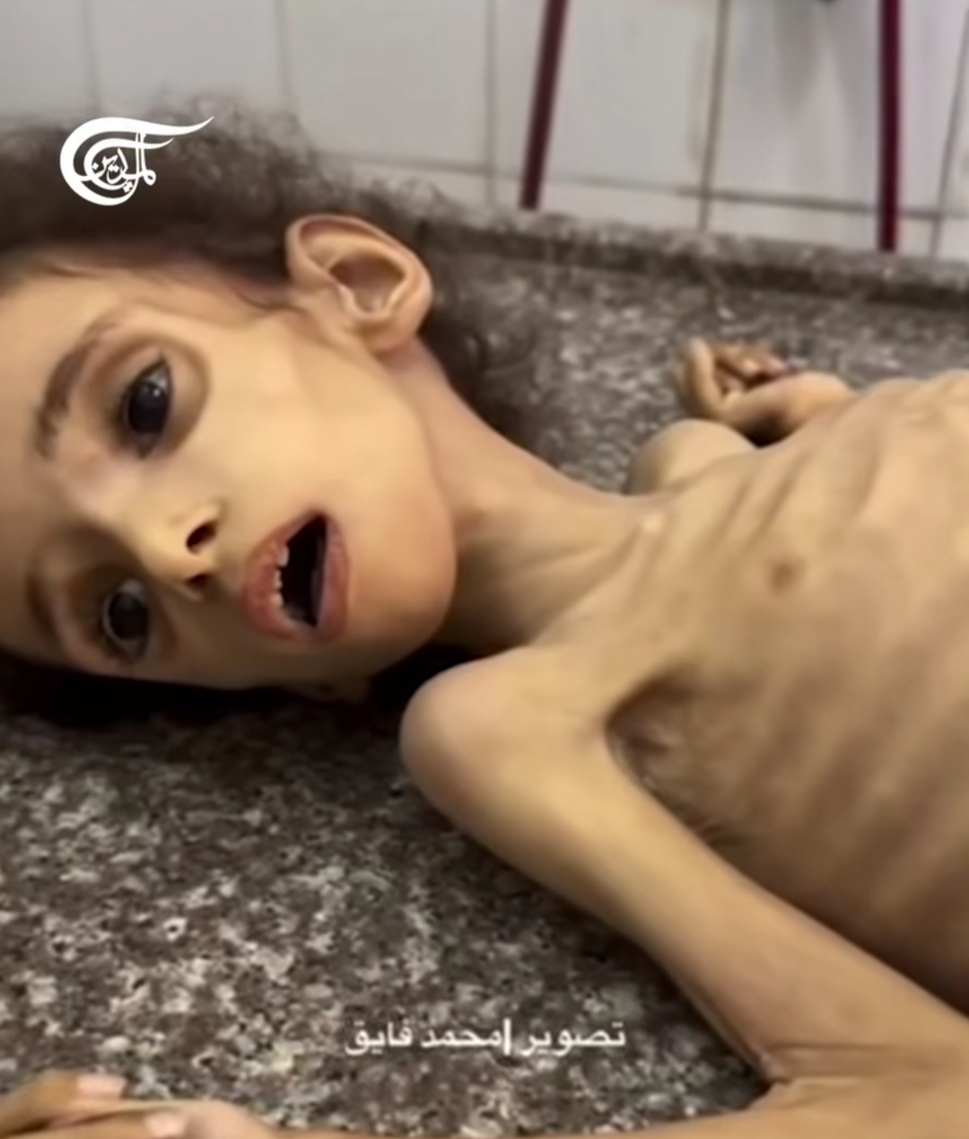 الطفلة رزان أبو زاهر ترتقي جوعاً في غزة المحاصرة
