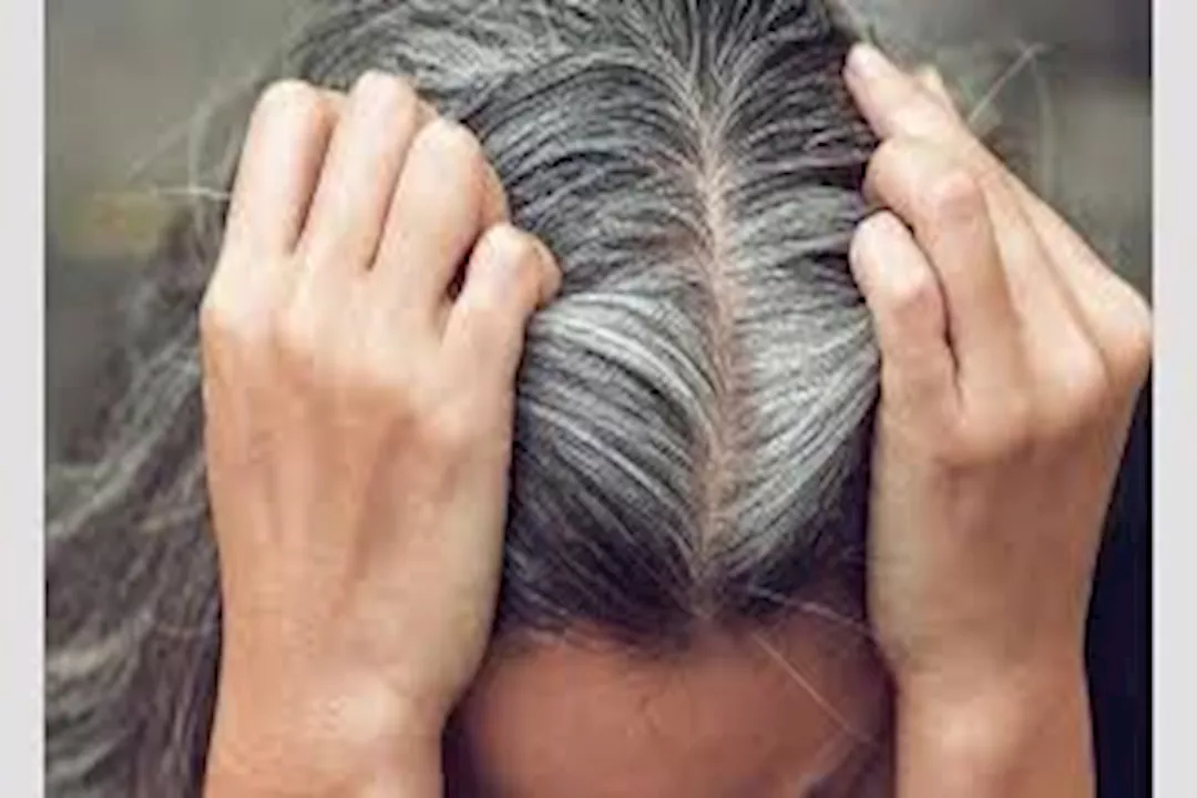 تعرف على أسباب شيب الشعر في سن الثلاثين- وهل لذلك دلالات خطيرة؟
