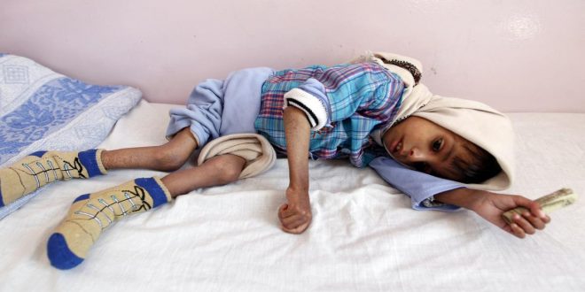 اليونيسيف تعلن عن عدد الأطفال المولودين منذ بداية الحرب على اليمن وضحايا وباء الدفتيريا