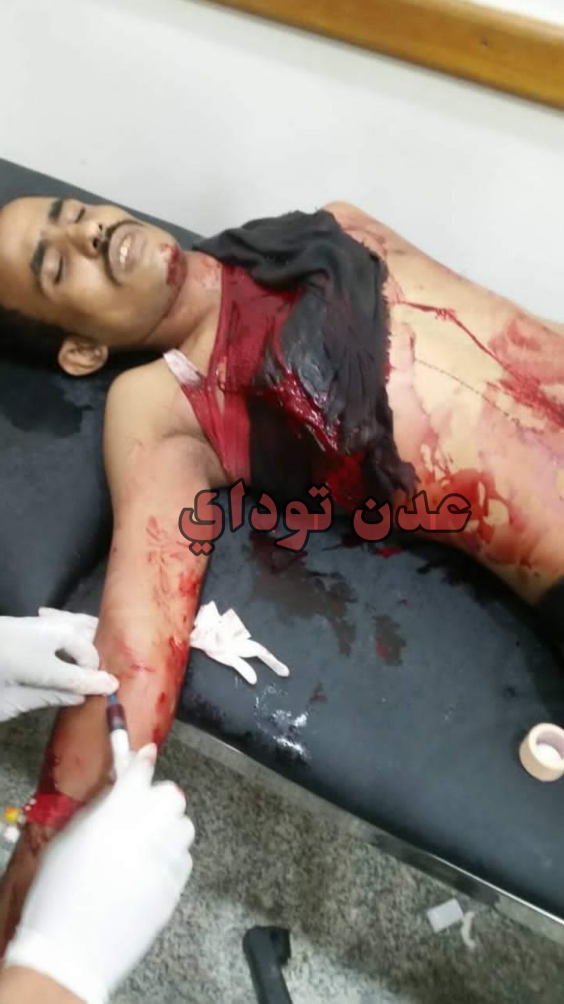 في حادثة أغرب من الخيال شاهد مافعله ثعبان عملاق بأحد المواطنين اليمنيين