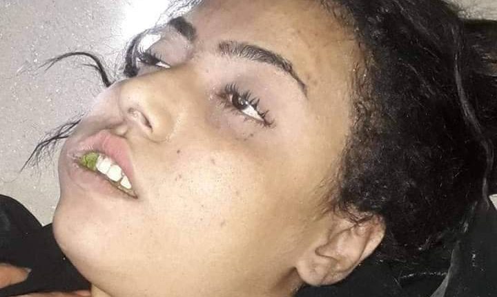 شاهد بالصورة التي ستظل وصمة عار على جبين كل مؤيدي العدوان من أبناء الجنوب خاصة اليمن عامه
