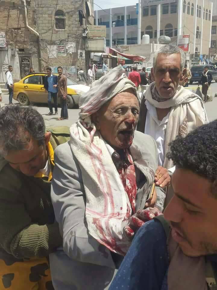 شاهد بالصور انتشال جثث القتلى والمصابين لقيادات من الصف الاول للحوثيين بغارات طيران العدوان لمكتب رئاسة الجمهورية