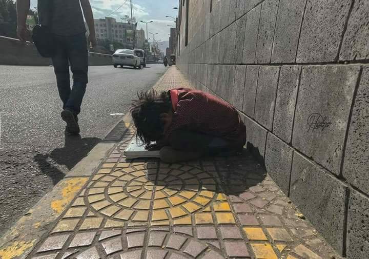 شاهد بالصور الشهيد..طفل الميزان قبل وبعد إستشهادة بغارات صلف تحالف العدوان الإجرامي
