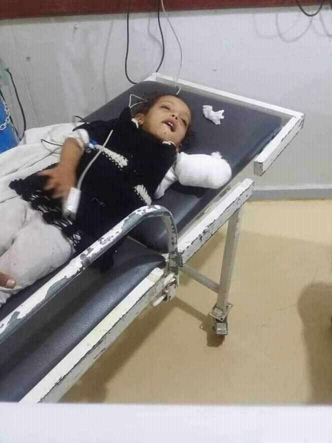 لأصحاب القلوب .. شاهد حيوان مفترس يلتهم ذراع طفله في حديقة الحيوان بأب
