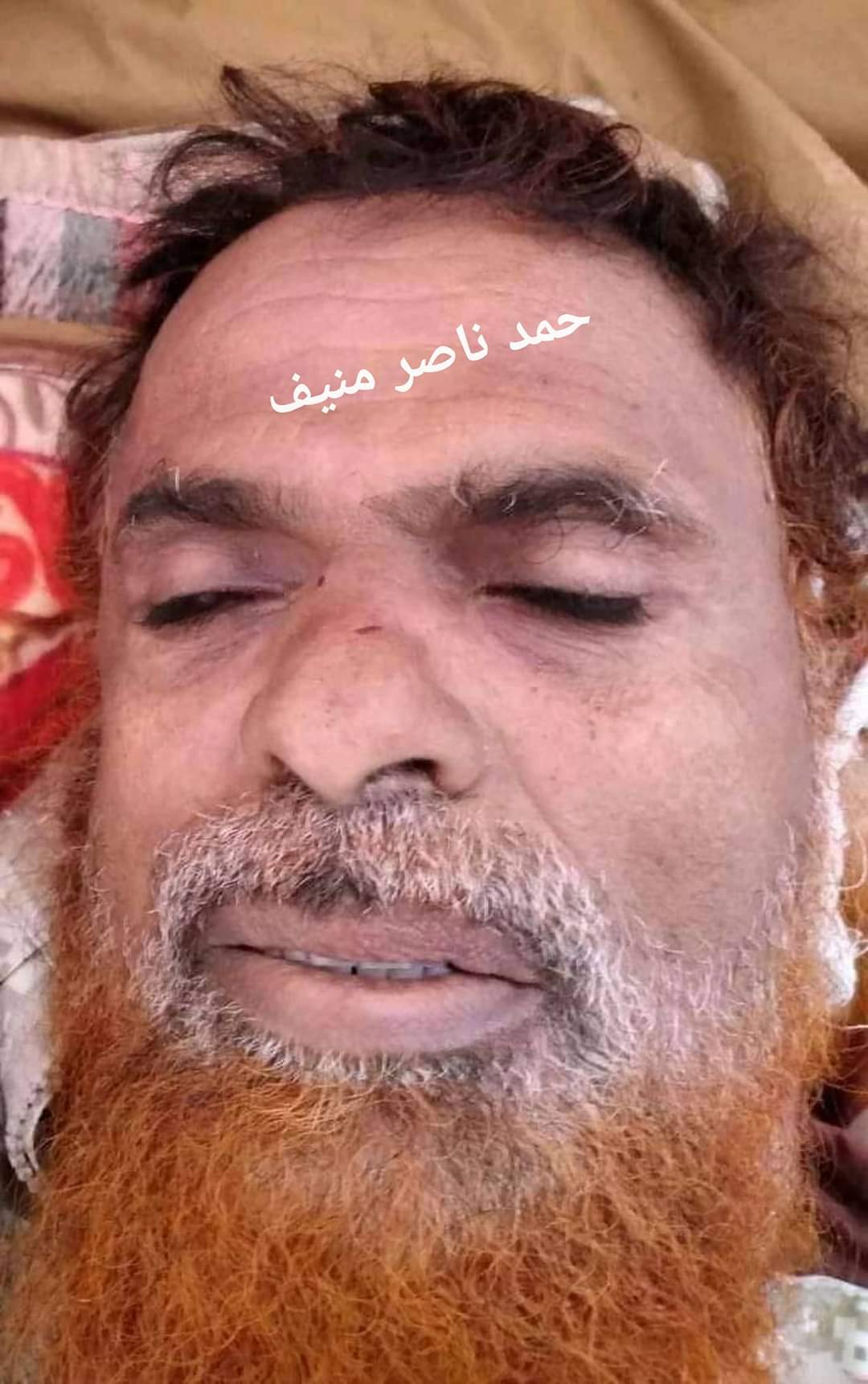 بعد تصفيه قيادات من القاعده في مأرب وتضييق الخناق على المرتزقه .. الجيش واللجان يخصصون ممرات للخروج الآمن