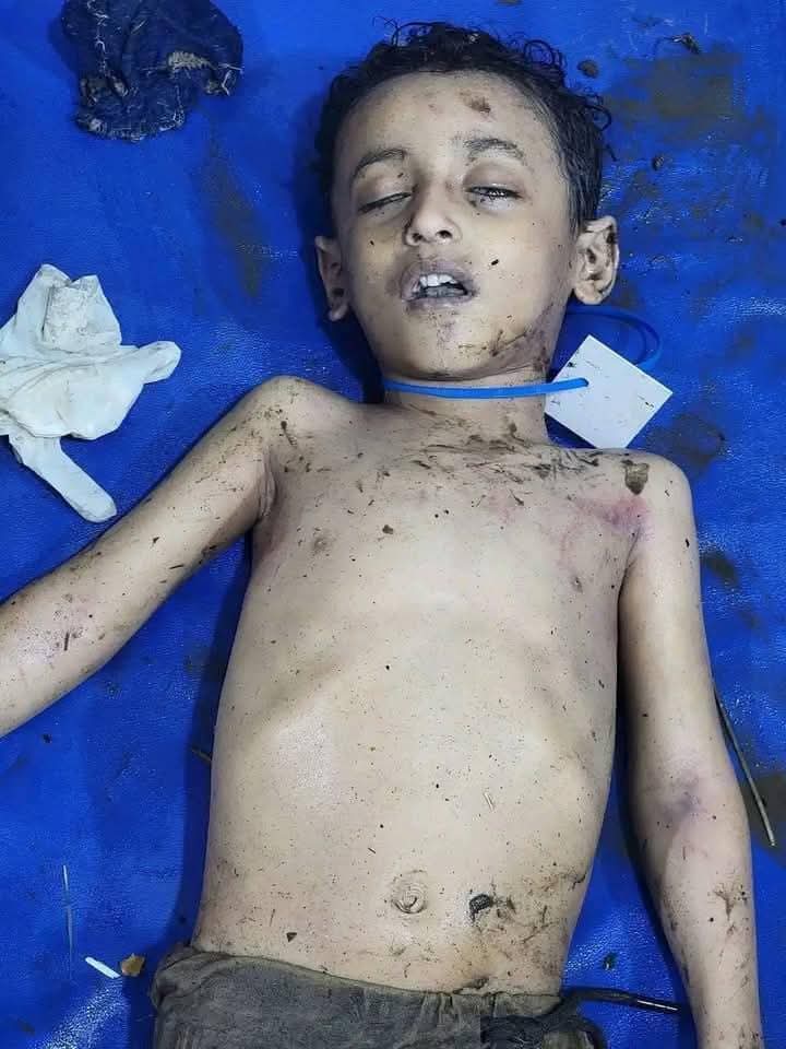فاجعة مؤلمة بمحافظة إب  .. صور + تفاصيل