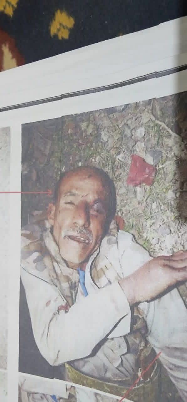 جريمة تهز الضمير.. ليست جريمة قتل بل حفلة تعذيب وحشية.. صور صادمة لعبدالسلام الطرصاني اشعلت موجة غضب واسعة