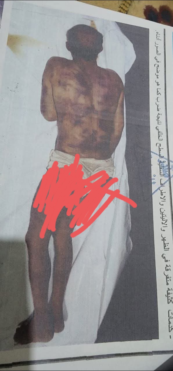 جريمة تهز الضمير.. ليست جريمة قتل بل حفلة تعذيب وحشية.. صور صادمة لعبدالسلام الطرصاني اشعلت موجة غضب واسعة