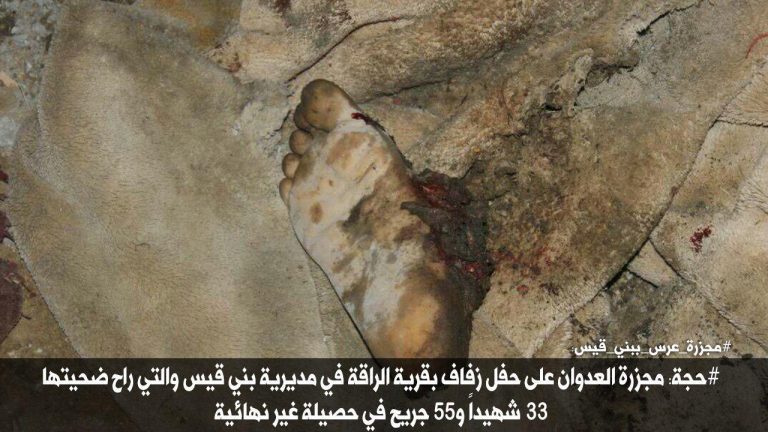 شاهد بالصور مجزرة حفل الزفاف بمحافظة حجة بينها صورة مؤلمة لطفل يحاول إيقاظ والده بعد إستشهاده بغارات طيران العدوان