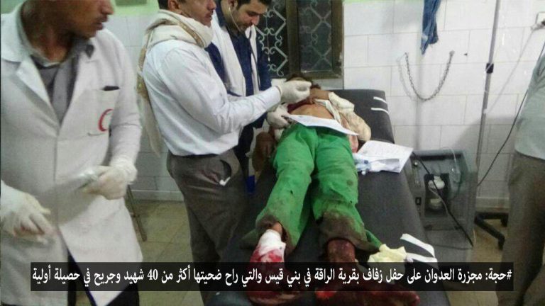 شاهد بالصور مجزرة حفل الزفاف بمحافظة حجة بينها صورة مؤلمة لطفل يحاول إيقاظ والده بعد إستشهاده بغارات طيران العدوان