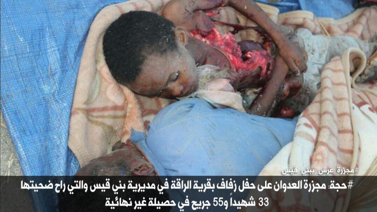 شاهد بالصور مجزرة حفل الزفاف بمحافظة حجة بينها صورة مؤلمة لطفل يحاول إيقاظ والده بعد إستشهاده بغارات طيران العدوان