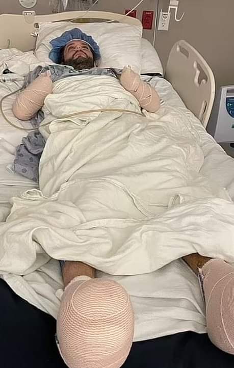 بتر ذراعيه وأجزاء من قدمه .. حشرة صغيرة تحول حياة شاب إلى مأساة حقيقية .. تفاصيل + صور