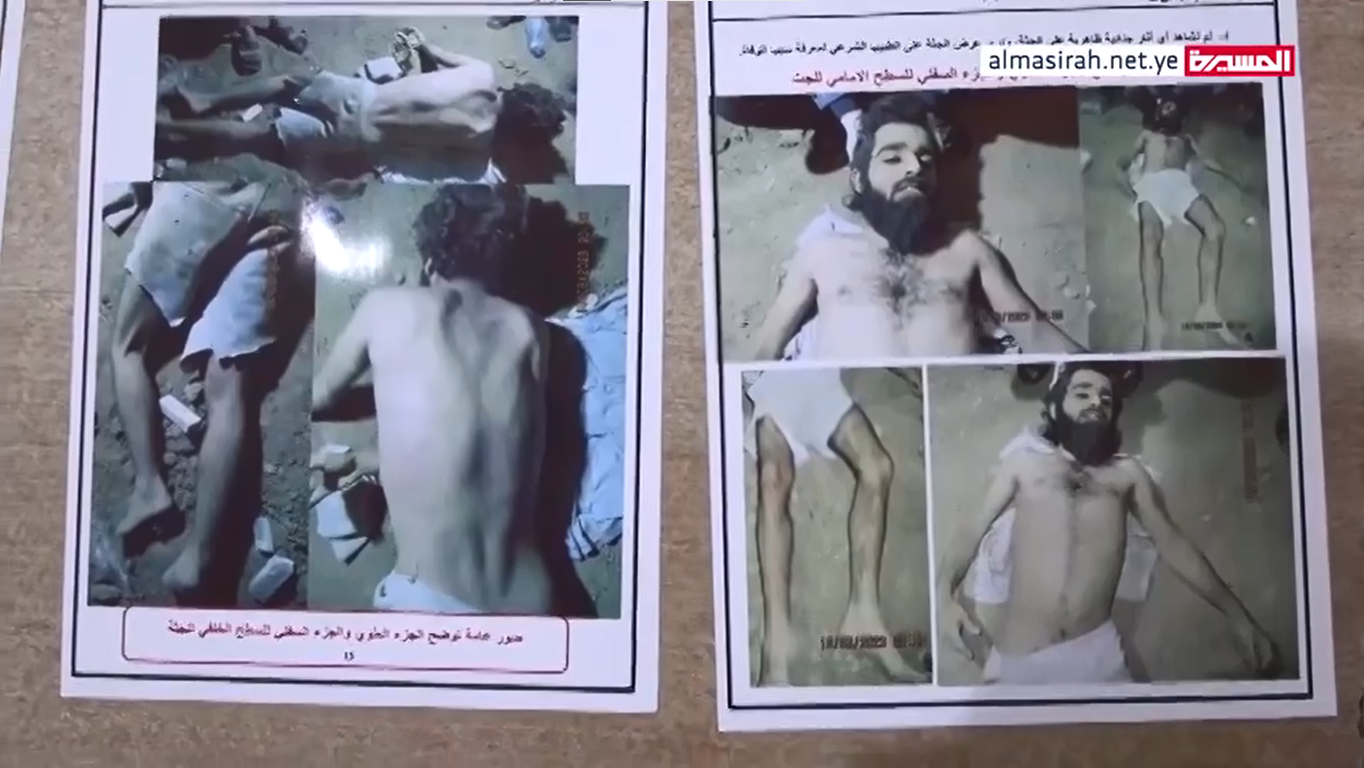 بالأدلة والبراهين الدامغة الكشف عن ماحصل لحمدي عبدالرزاق الخولاني الملقب بالمحل في محافظة إب (بيان)