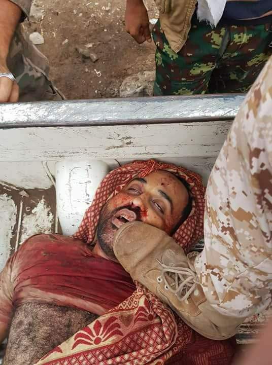 شاهد بالصورة جندي إماراتي يدوس “ببيادته” العسكرية وجه قتيل في مدينة عدن